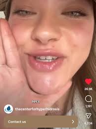 Darcie Hamilton, 22, from near Ayr, Scotland, has lived with severe  hyperhidrosis since she was around 10 when she began noticing she sweat  more than her classmates 🚨🔗 Full story at link in bio