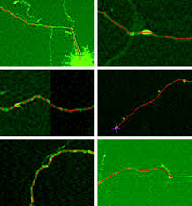 Renata, kornel and serje on video. Design And Validation Of A Tool For Neurite Tracing And Analysis In Fluorescence Microscopy Images Meijering 2004 Cytometry Part A Wiley Online Library