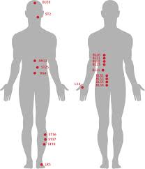 Image result for Acupuncture