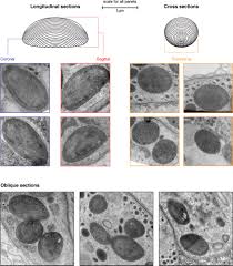 2.3.3 identify structures from 2.3.1 in electron micrographs of liver cells. Transmission Electron Micrographs Of Darkly Stained Organelles In Download Scientific Diagram