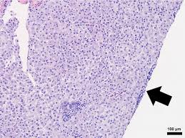 Streptococcus iniae challenge induces minimal acute histopathological  changes in Nile tilapia (Oreochromis niloticus) selectively bred for  disease resistance