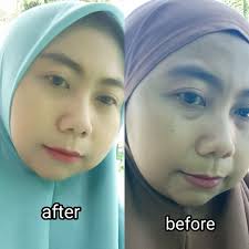 SOLCARE Heavenly Eye Serum