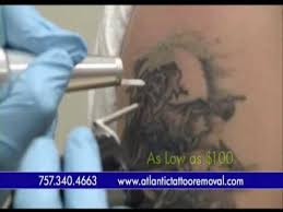3200 downwood cir nw, ste 360. Atlantic Laser Tattoo Removal Youtube