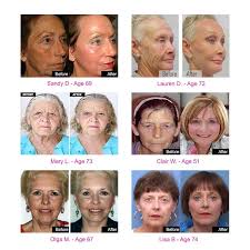 Image result for 01839373442