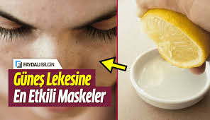 Gunes Lekesi Nasil Gecer Gunes Lekeleri Icin Maskeler Ve Korunma Yollari Tatil Sonrasi Olusan Bu Cilt Lekeleri Ile Nasil Ba Maskeler Tatiller Cilt Beyazlatma