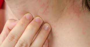 Neck Itch Symptoms Causes Treatments