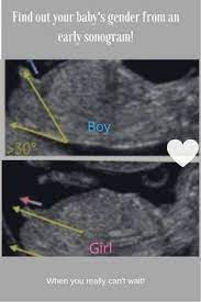 Check spelling or type a new query. Are You Desperate To Find Out The Gender Of Your Baby And Can T Wait For The Gender Scan Try These Finding Out Baby Gender Baby Gender Baby Gender Ultrasound