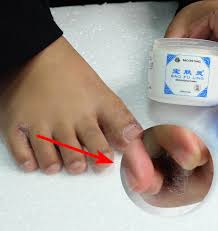Bao fu ling skudai sihtnumber 81300. Bao Fu Ling 3 Healthify