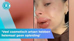 Fillerfoutje? Steeds vaker complicaties bij cosmetische ingrepen - YouTube