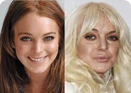 10 unrecognizable stars after plastic surgery (good and bad)