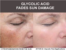 Pin On Get Glowing Skin