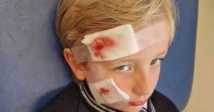 Boy, 7, horrifically injured after being 'bitten