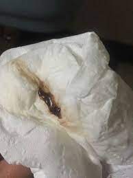 But in many cases it is no cause for concern. Understanding Bleeding And Spotting During Pregnancy Facebook