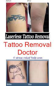 Pin On Tattoo Removal