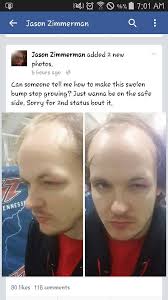 Annoying Commentators in Melee Hell