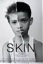 奥斯卡最佳真人短片《Skin皮肤》：耐人寻味的黑色寓言_白人