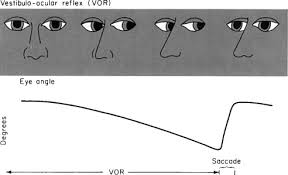 Image result for Oculovestibular Testing