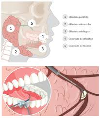 Image result for Sialoadenitis