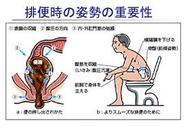 「洋式トイレ姿勢」の画像検索結果