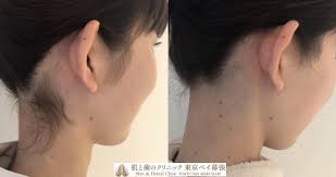 English translation by hoshi yuki. æ­»ã®é¡Ž ã‚¯ãƒ©ã‚¦ãƒ‰ æ‰€æŒ å¾Œã‚Œæ¯› è„±æ¯› Nekopunch Jp