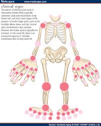 Medscape Log In Arthritis Rheumatoid Arthritis Inflammatory Arthritis