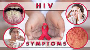 After being infected with hiv, you might feel unwell for a short time. Hiv Symptoms In Men And Women Week By Week Hiv Symptoms After 2 Weeks Youtube
