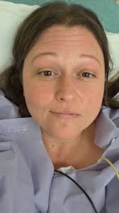 Preparing for gastric sleeve surgery