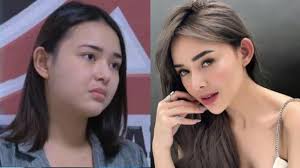 Transformasi Amanda Manopo Turun Berat Badan 15 Kg, Wajah Tirus Sampai  Dituduh Oplas, Ini Rahasianya