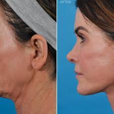 Jason Leedy's Instagram, Twitter & Facebook