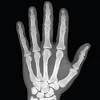 Hand bone anatomy anatomy bones human body anatomy human anatomy and physiology muscle anatomy wrist anatomy radiology student hand | definition, anatomy, bones, diagram, & facts. 1