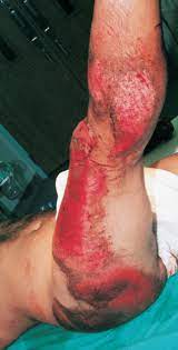 Impact Of Trauma Consultant360