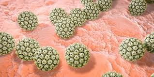 Sedangkan penyebab banyak kematian pada kaum wanita adalah virus hpv tipe 16 dan 18. Virus Hpv Sebabkan Kanker Serviks Simak Penjelasannya