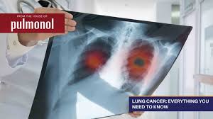 Knowing which stage the cancer is at is useful in deciding the right treatment. Lung Cancer Everything You Need To Know Respiratory Health Oladoc Com