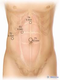 This article incorporates text in the public domain from page 460 of the 20th edition of gray's anatomy (1918) external links. How Do I Do It Laparoscopic Cholecystectomy Majumder Annals Of Laparoscopic And Endoscopic Surgery