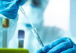 Antibody testing is an important step to tell if someone has been previously infected. Cdc Lab Contamination Delayed Coronavirus Testing The Scientist Magazine