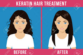 Hair Care Before And After Keratin Treatment Split Ends Damaged Royalty Free Cliparts Vectors And Stock Illustration Image 113022451