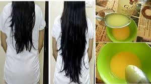 Pendant Longtemps Nous Avons Associe La Perte De Cheveux Et La Calvitie A La Vieillesse M Croissance Des Cheveux Pousse Des Cheveux Faire Pousser Les Cheveux