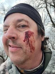 Hi! Just curious, I have poor eyesight. Do you wear contact lenses or  something when freediving so you can see underwater? 😄