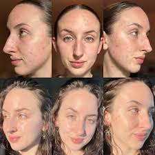 Emily Coloma • EmCo Esthetics