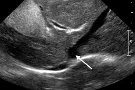 Current treatment for dogs with hemangiosarcoma. Imaging Essentials Small Animal Abdominal Ultrasonography
