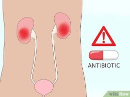 To lower creatinine levels, you should stay away from creatine, limit vigorous exercise, eat more fiber and less protein, or try supplements. 6 Ways To Bring Down High Creatinine Levels Wikihow
