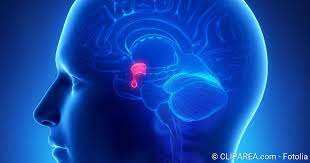 Hypophysenadenom Formen Symptome Behandlung Netdoktor