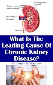 Kidney Stones Doterra Kidney Disease Kidney Infection Kidney Failure Diet