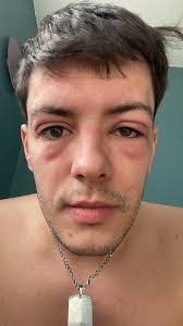 Aiden Kane's Instagram, Twitter & Facebook