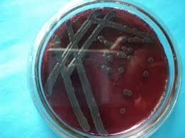 If only atypical colony morphology is observed on xld. Salmonella Colony On Xld Agar Download Scientific Diagram