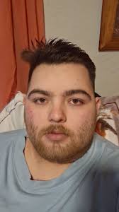 Hi all, 51 years old and from the Netherlands. Had my third TGA earlier  today. It lasted only for 15-20 minutes, just like the 2nd one this summer.  So both shorter than