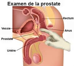 Topic j'ai l'anus qui me gratte mdr. Douleur De L Anus Symptomes Traitement Definition Docteurclic Com
