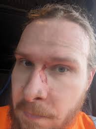 Always take recommended safety precautions at work