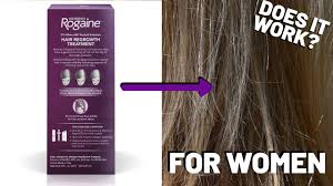 rogaine for women the best hair loss