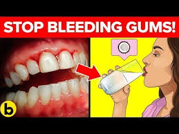 If the bleeding does not stop within 5 minutes, continue to apply pressure on the wound while transporting the dog to the veterinarian. 16 Expert Techniques For Stopping Your Bleeding Gums Youtube Bleeding Gums Bleeding Gum Bleeding Gums Remedies